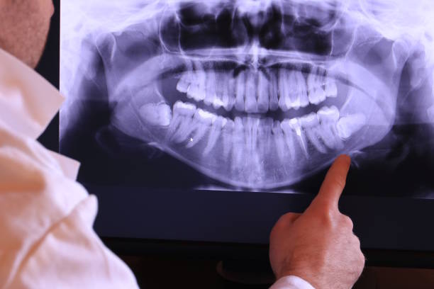 Teeth Whitening in OR